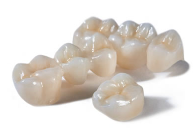 dantu protezavimas ukmergeje